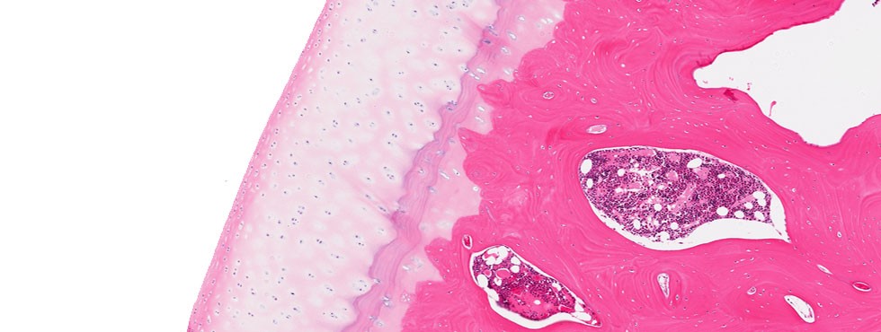 ArthritoMab Antibody Cocktail produces significant damage at the histological level in just 12 days in the collagen antibody-induced arthritis (CAIA) model